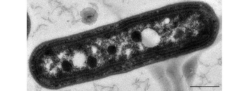 Electron micrograph of Synechococcus elongatus